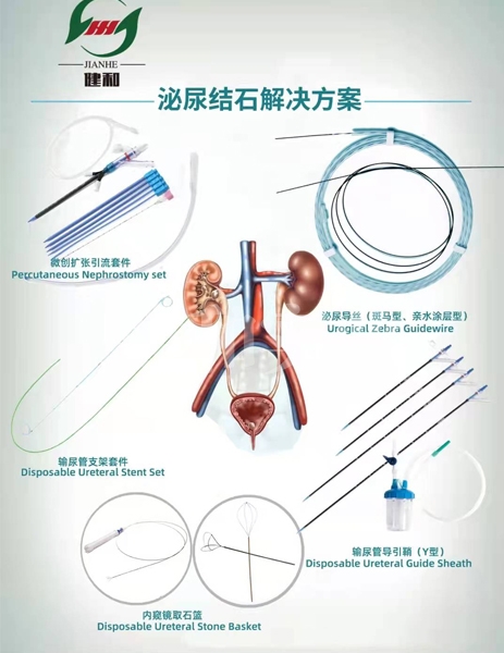 泌尿結石解決方案